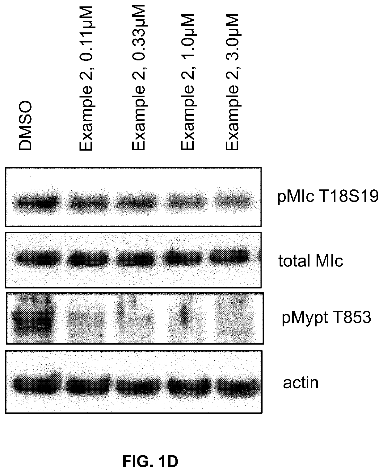 Inhibitors of Rho associated coiled-coil containing protein kinase