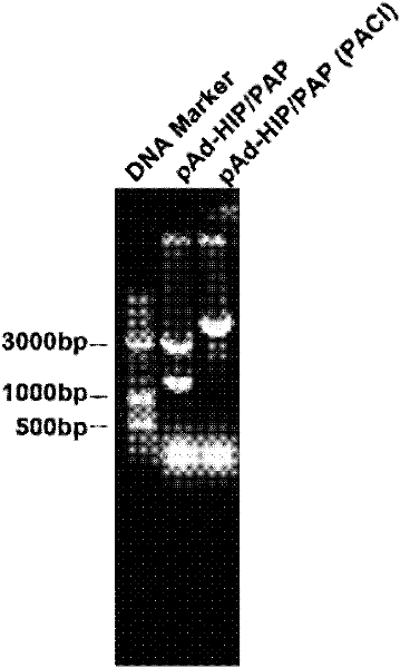 HIP/PAP recombinant adenovirus and application thereof in resisting ulcerative colitis