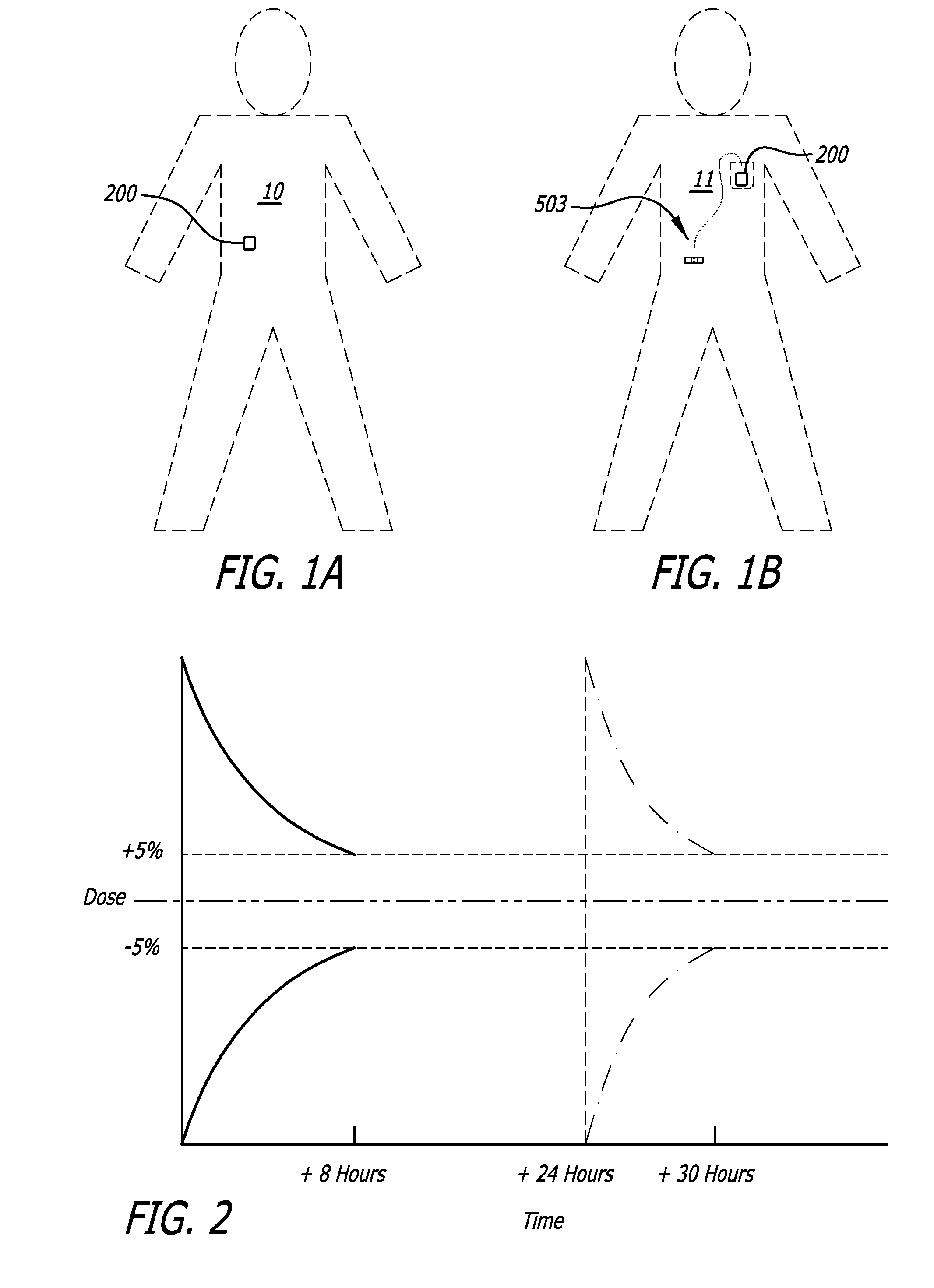 Infusion pumps