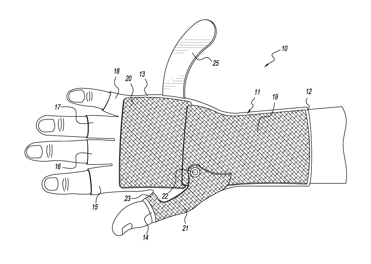 Hand Orthoses