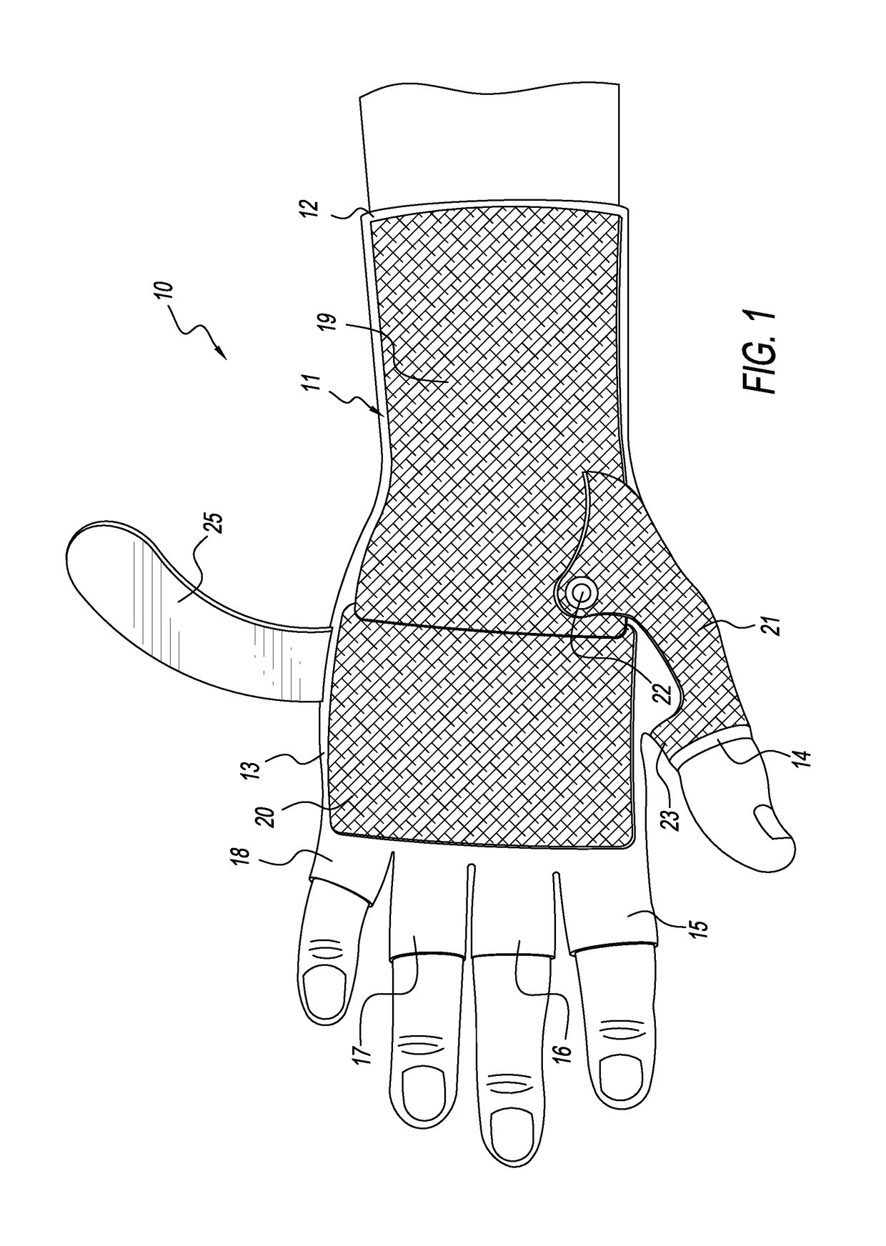 Hand Orthoses