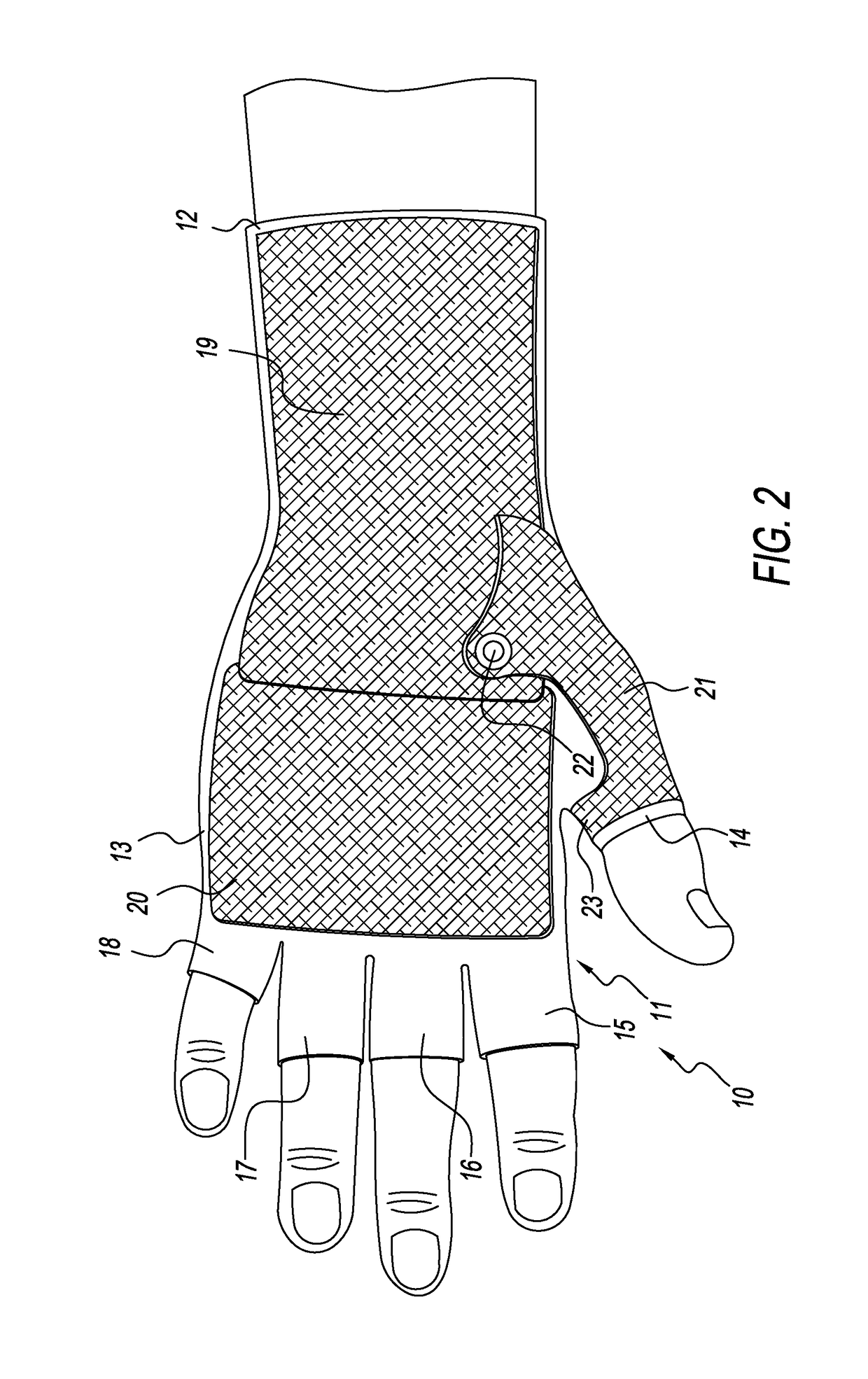 Hand Orthoses