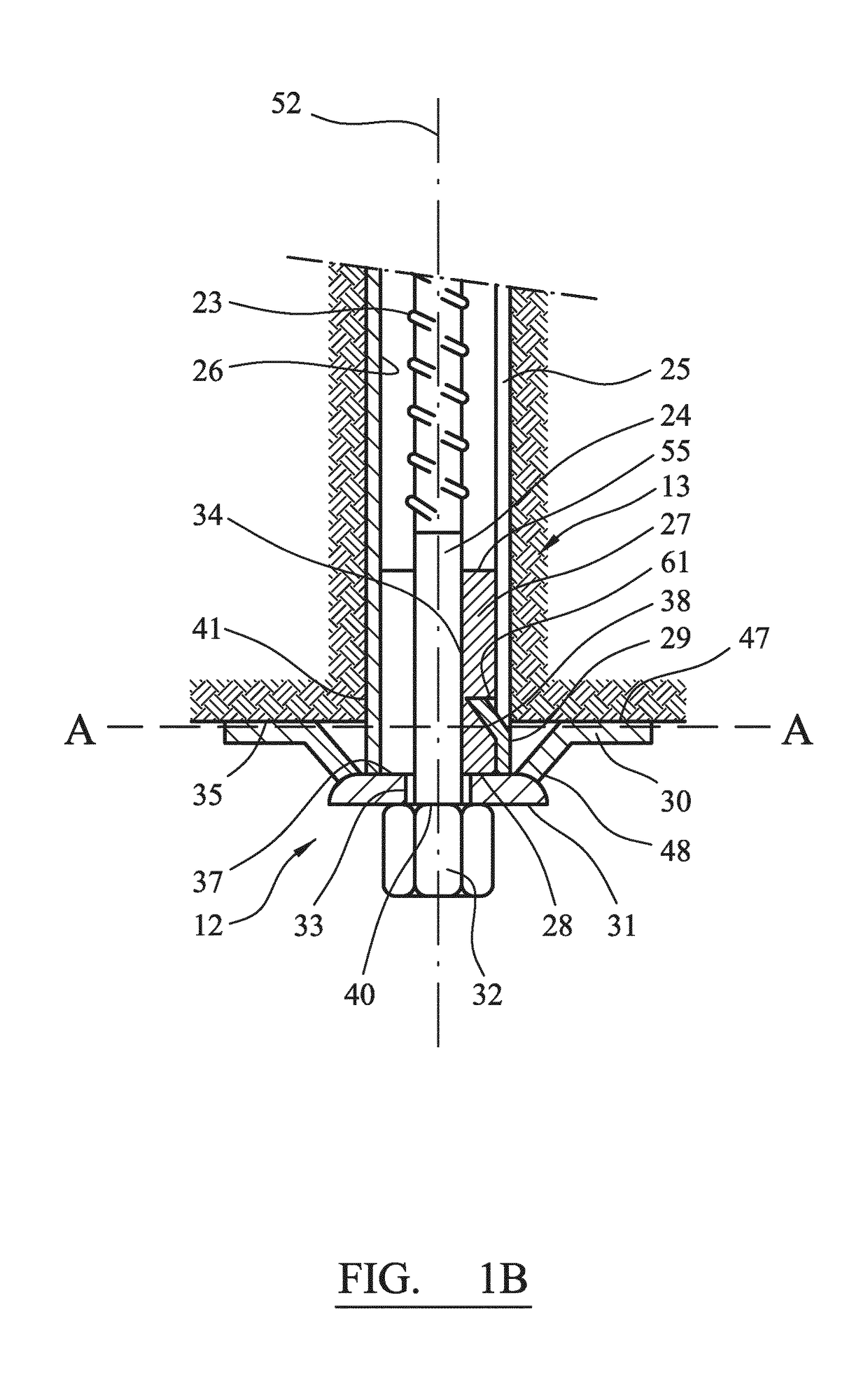 Friction bolt