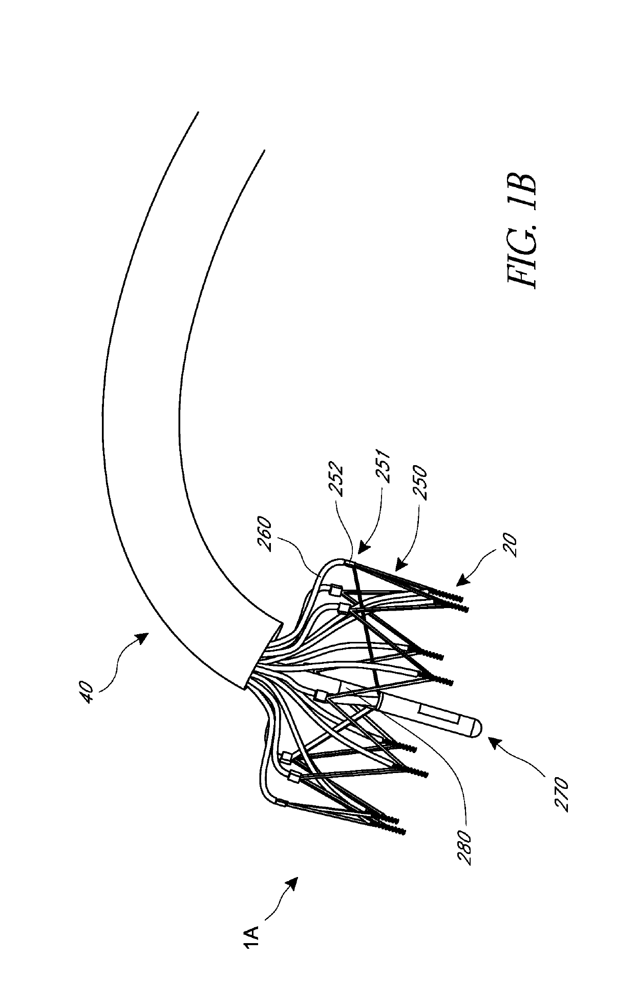 Methods for delivery of heart valve devices using intravascular ultrasound imaging