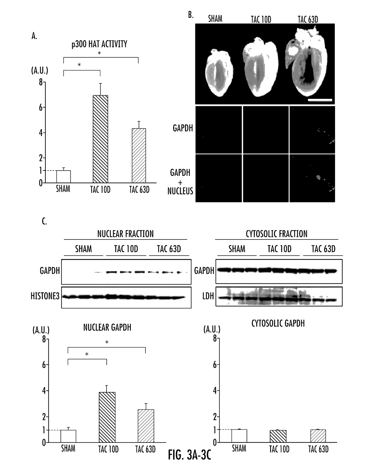 Gapdh cascade inhibitor compounds and methods of use and treatment of stress induced disorders including mental illness