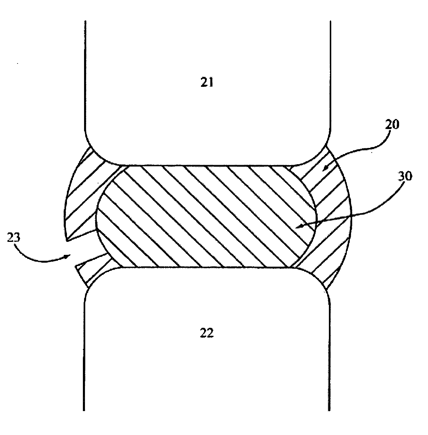 Devices and methods for explantation of intervertebral disc implants