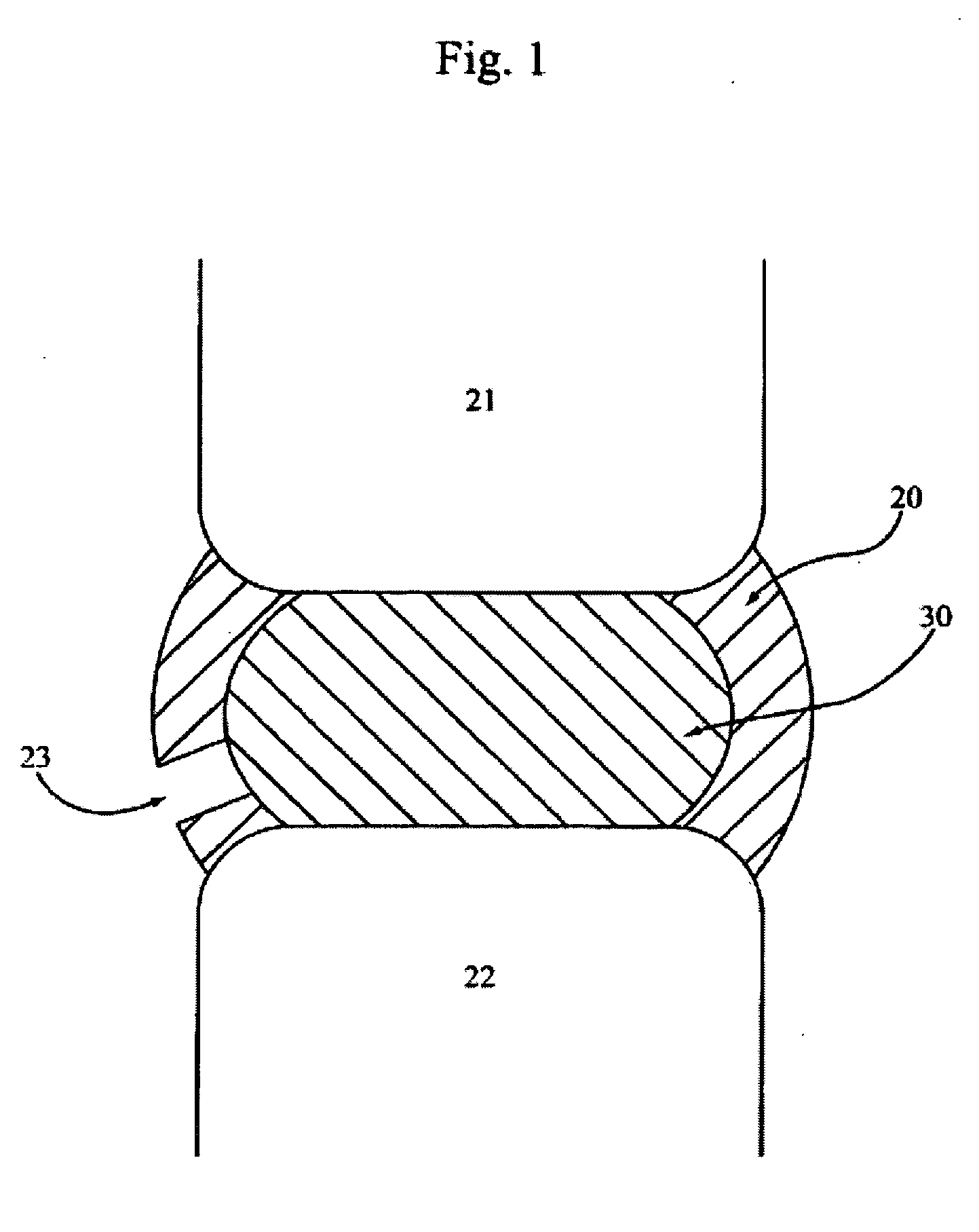 Devices and methods for explantation of intervertebral disc implants