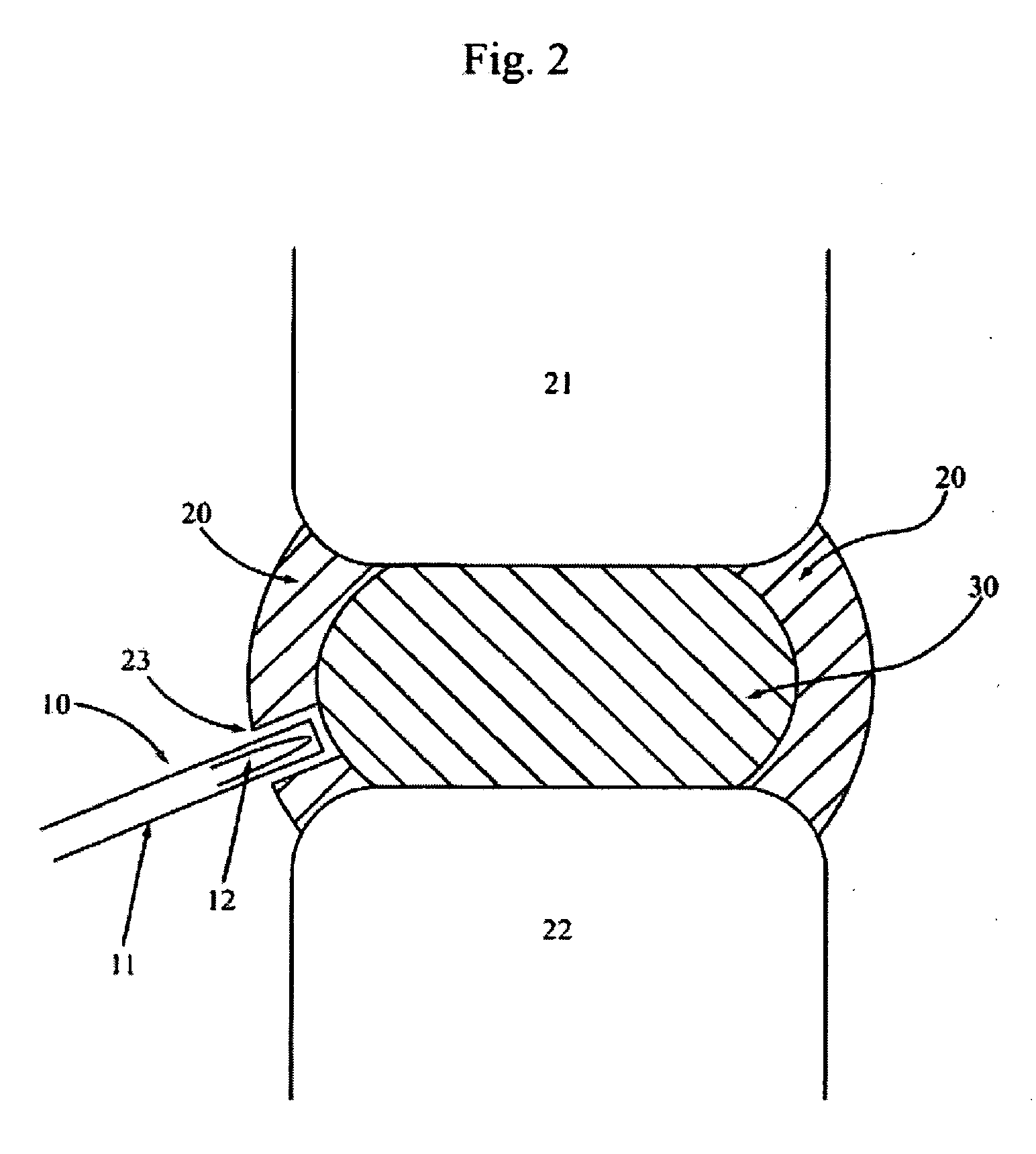 Devices and methods for explantation of intervertebral disc implants