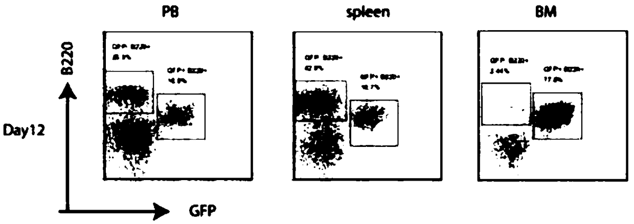 Ph+ acute B lymphocytic leukemia KQBL-84 cell line and construction method and application thereof