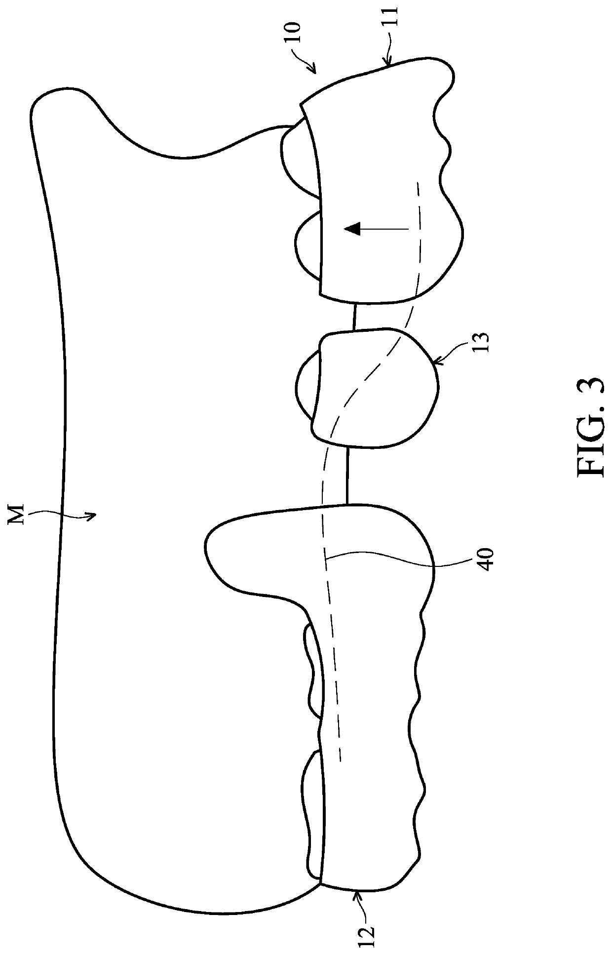 Orthodontic space closure device