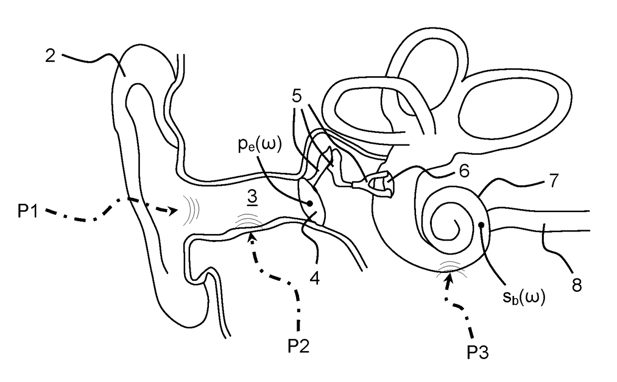 Controlling own-voice experience of talker with occluded ear