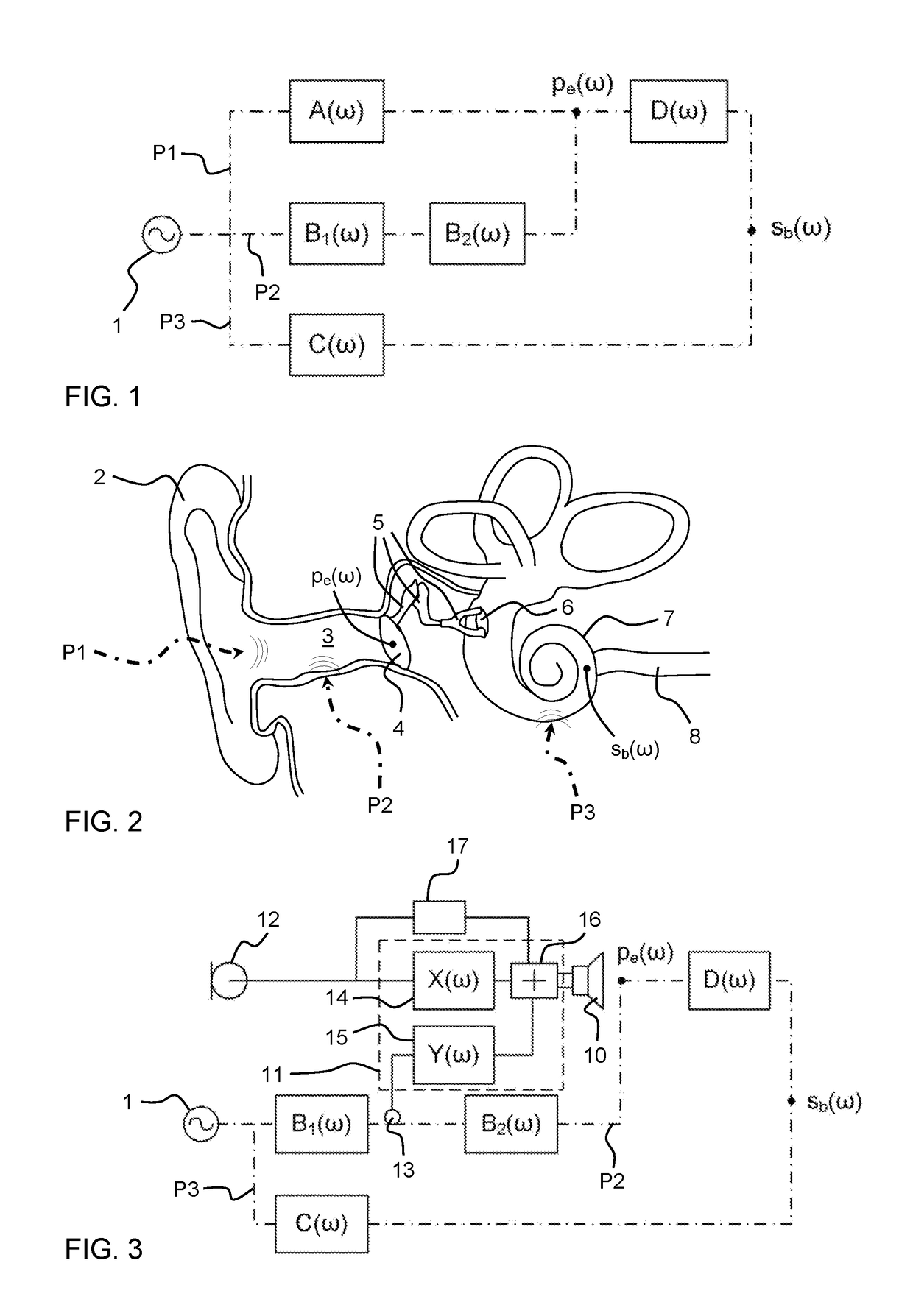 Controlling own-voice experience of talker with occluded ear