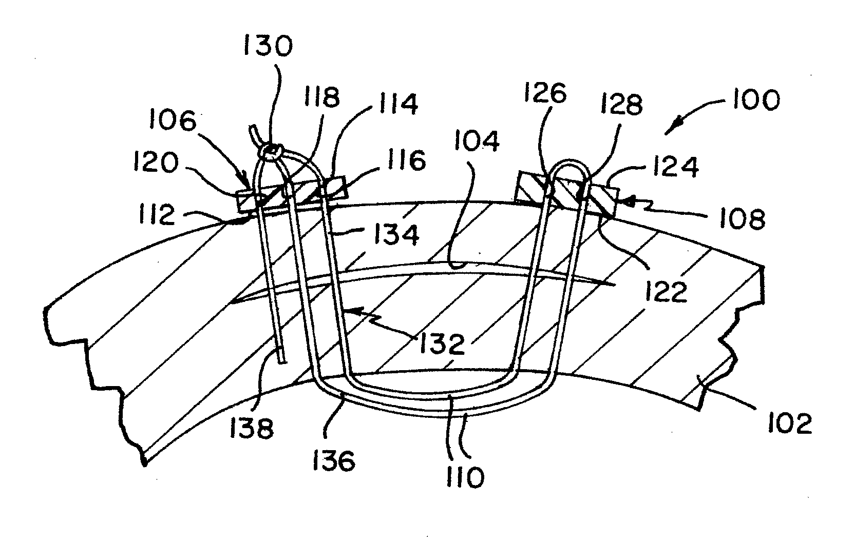 Apparatus and method for repairing tissue