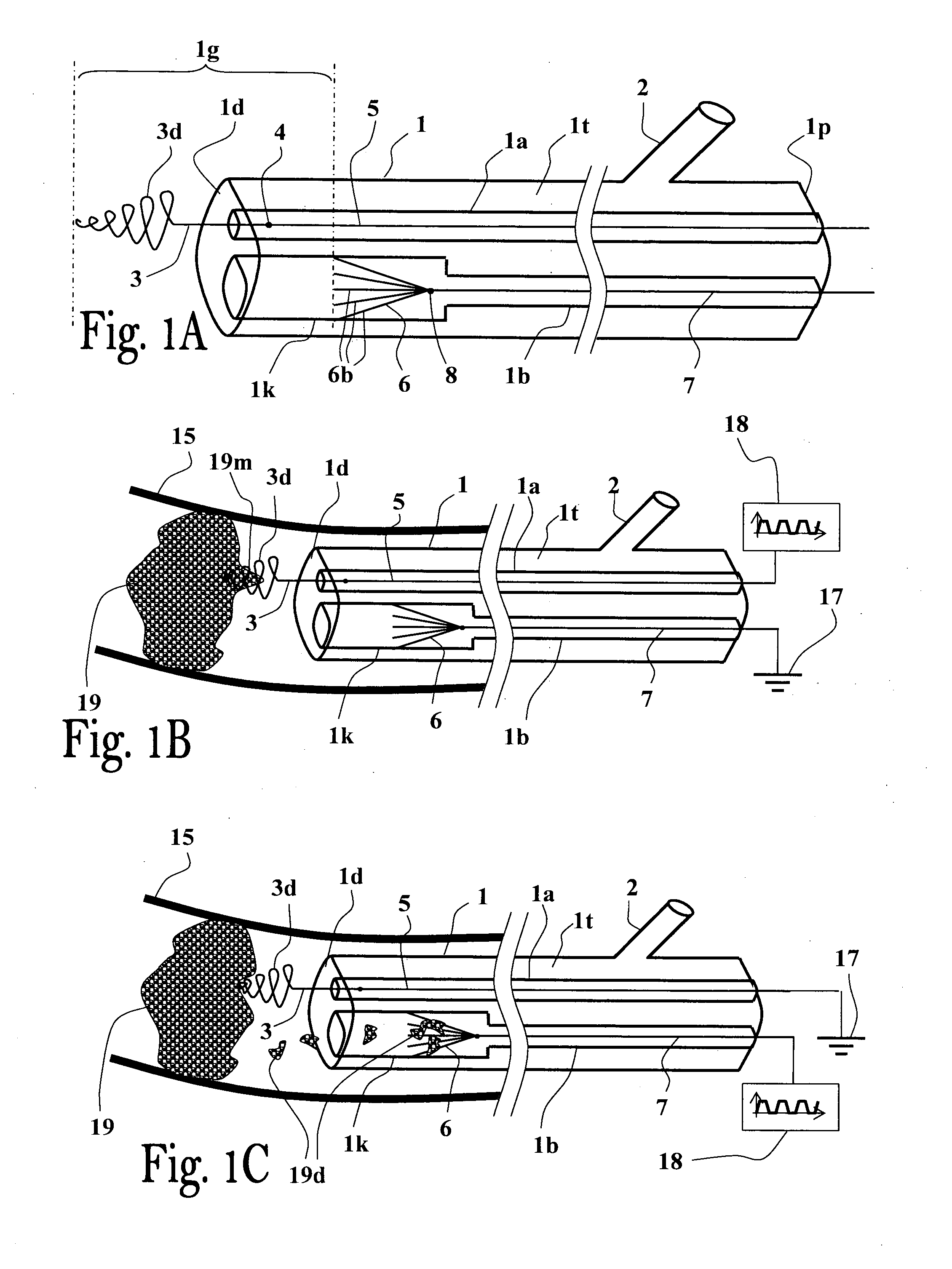 Method and apparatus for thrombus dissolution/thrombectomy by an electrode catheter device