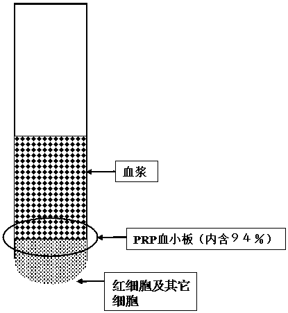 A kind of preparation method of platelet-rich plasma