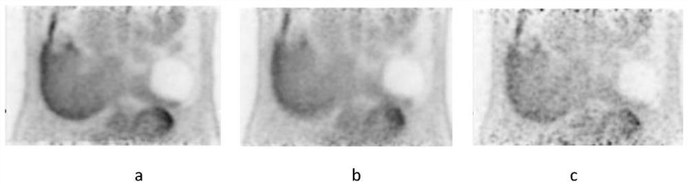 Correction information acquisition method for performing attenuation correction on PET images of breath or heart