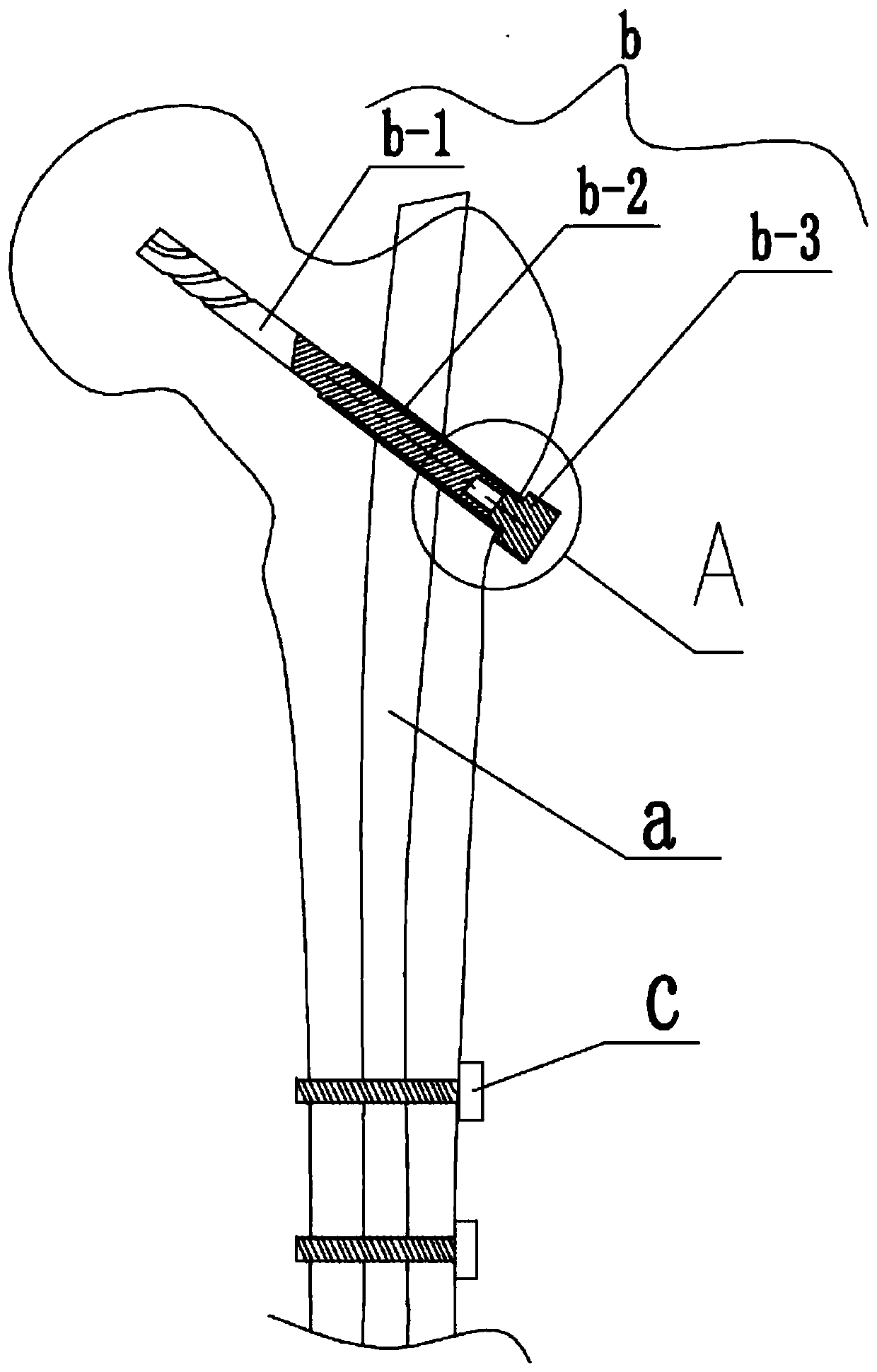 Proximal femoral nail extractor