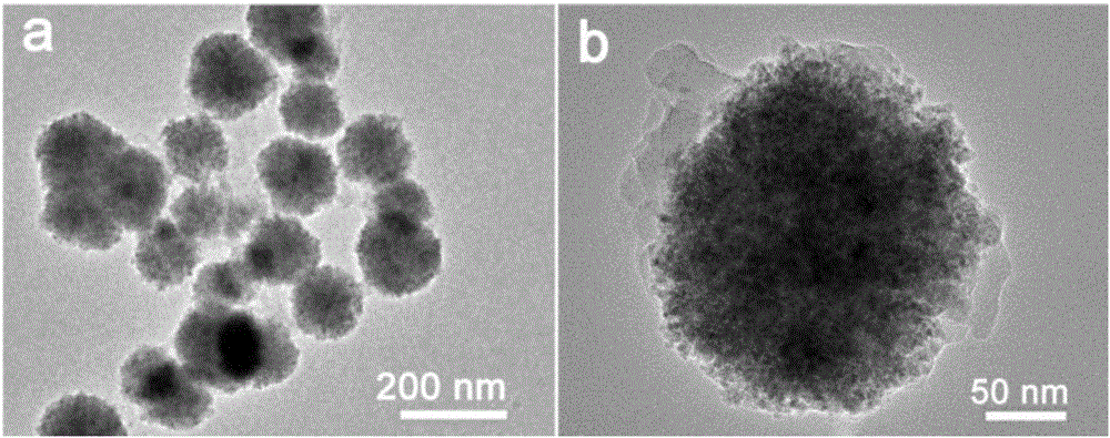 Ferroferric oxide/chitosan/indocyanine green composite particles and preparation method and application thereof