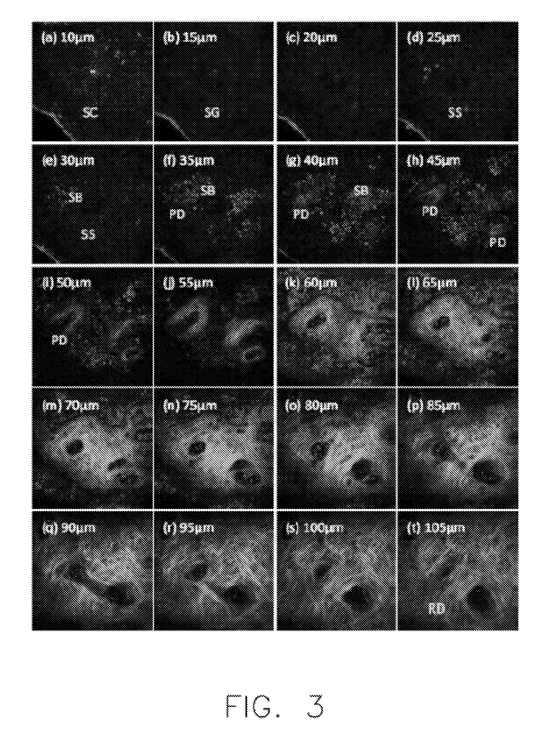 Method for diagnosing skin disease based on in vivo skin imaging