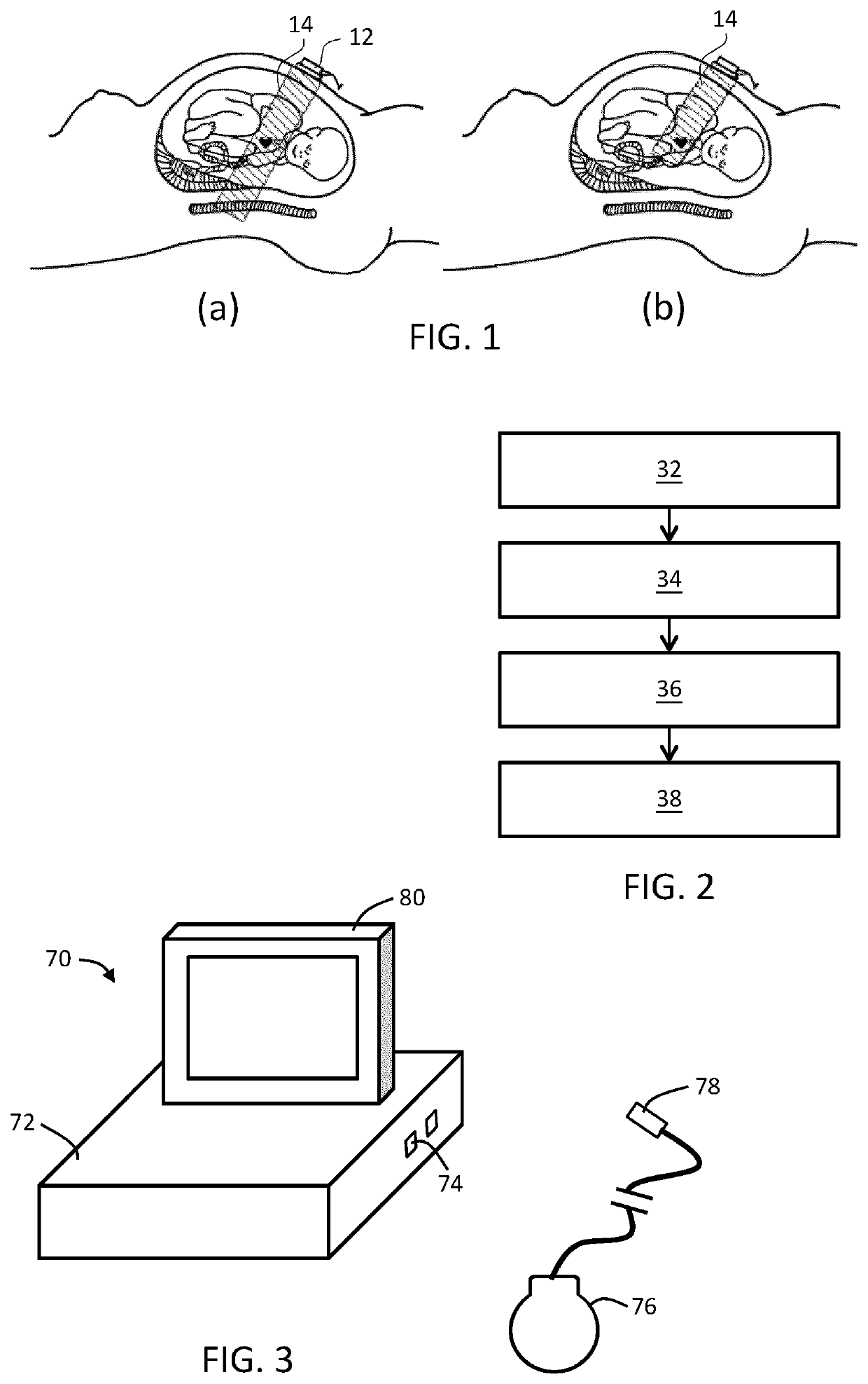 Fetal ultrasound processing unit