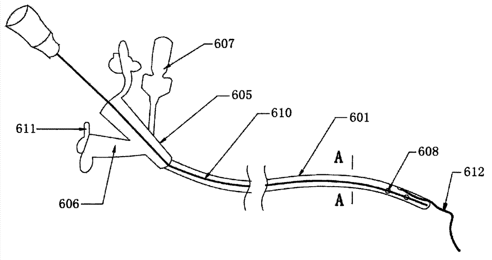 Novel three-cavity gastrointestinal tube