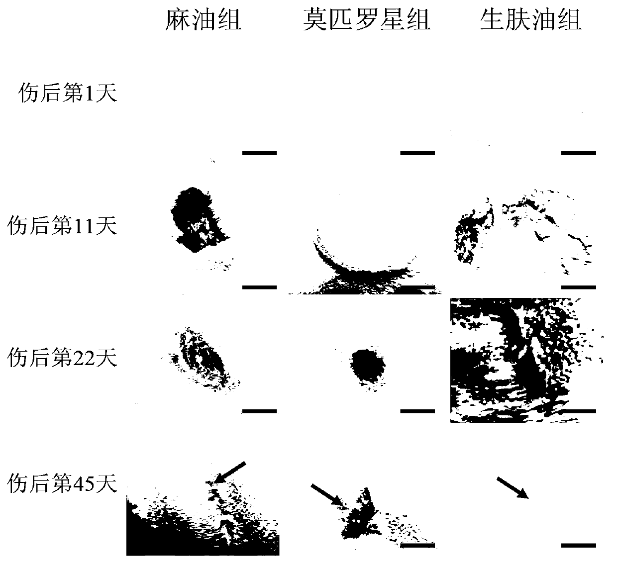 Externally-applied skin-generating oil for treatment of burn and preparation method and application thereof