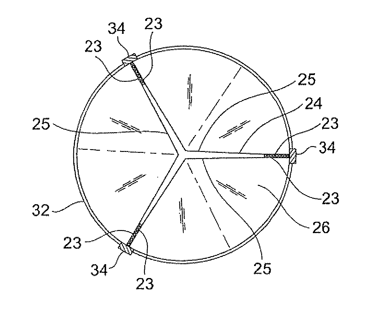 Implantable prosthetic valve with non-laminar flow