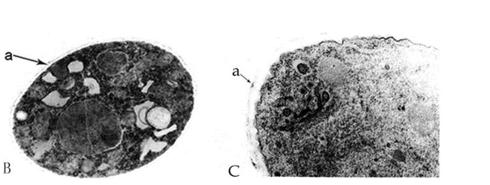 Quinomycin-A preparation and preparation method and application thereof