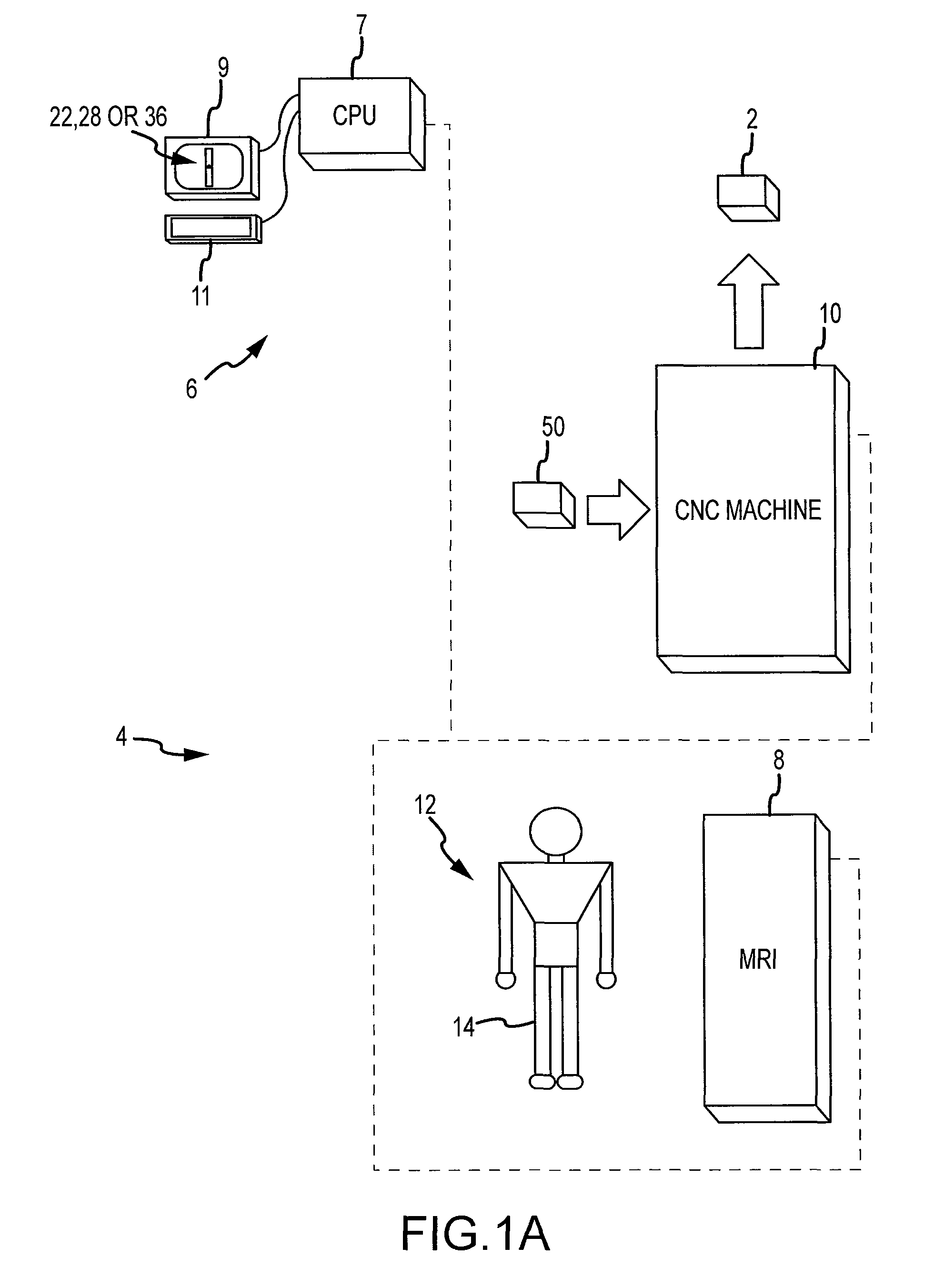 Generation of a computerized bone model representative of a pre-degenerated state and useable in the design and manufacture of arthroplasty devices