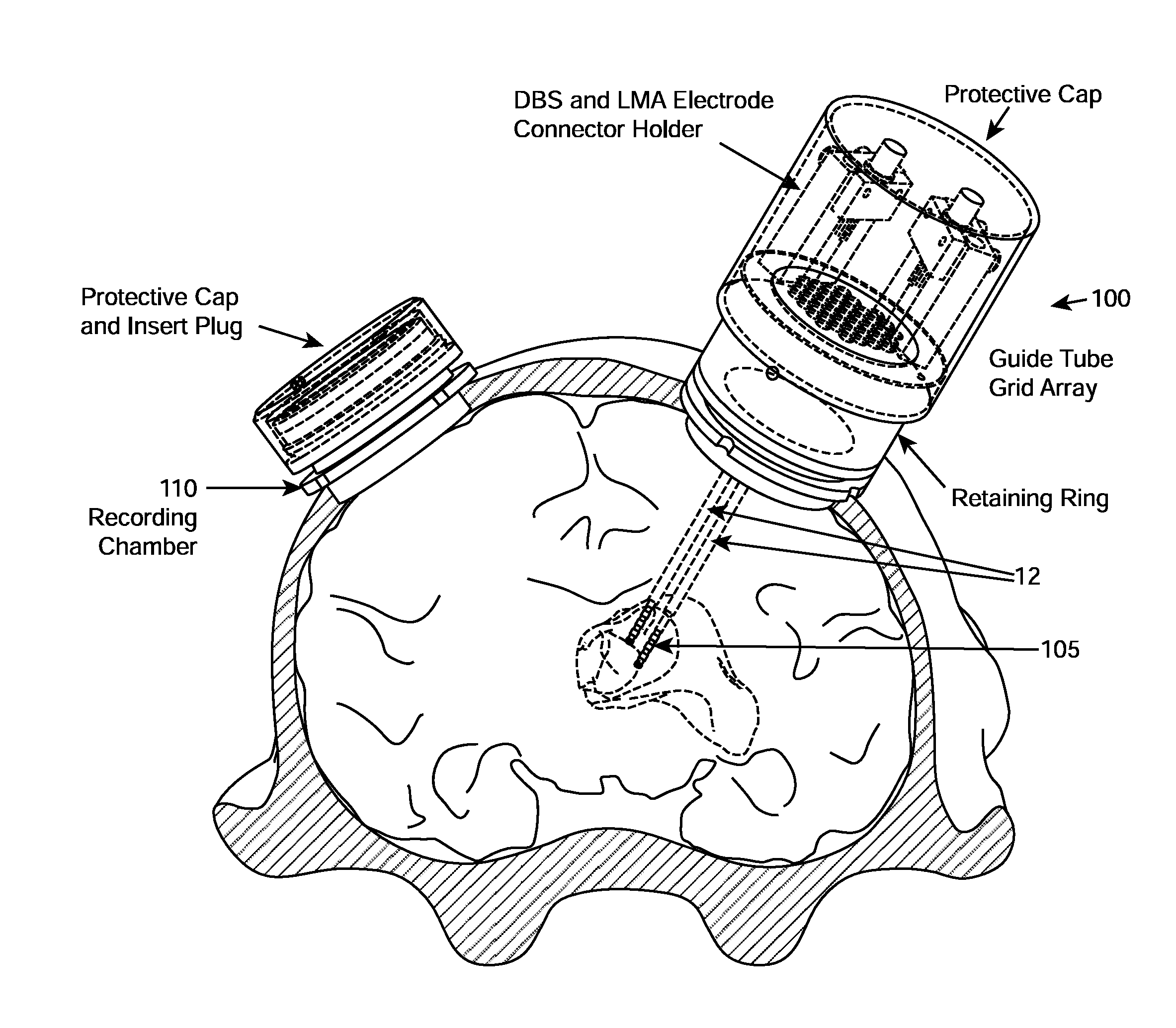 System and methods for multi-site activation of the thalamus