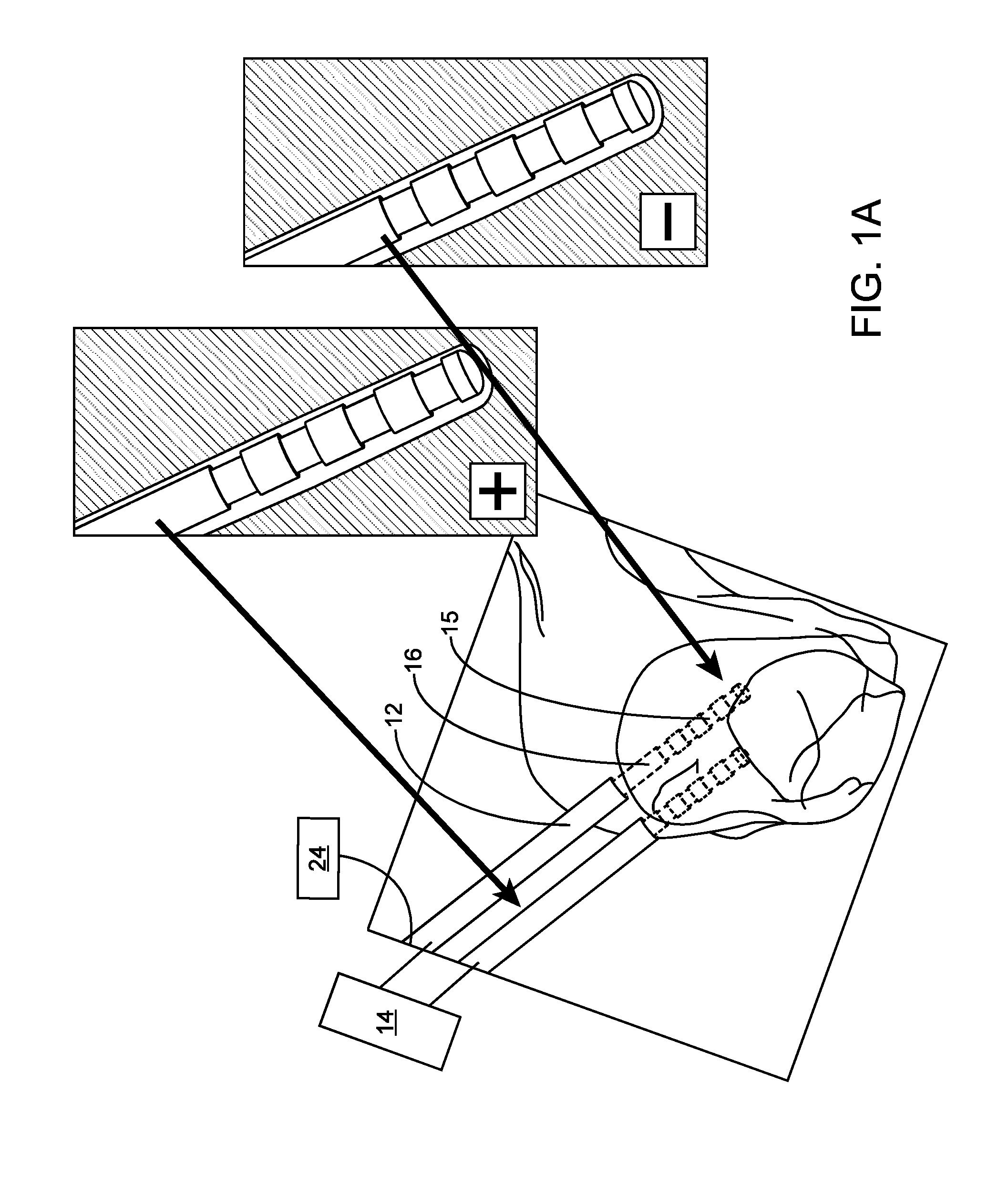 System and methods for multi-site activation of the thalamus