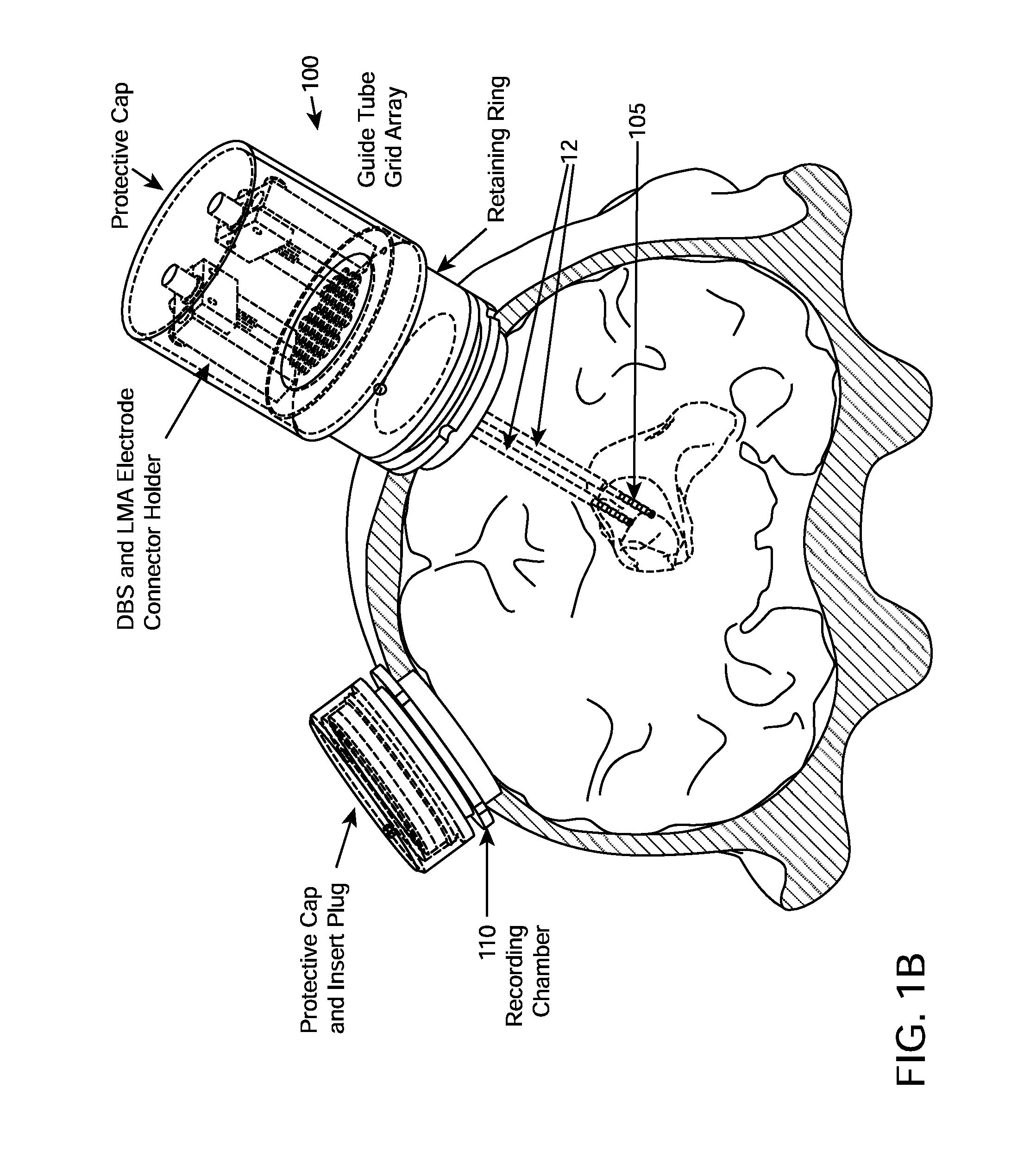 System and methods for multi-site activation of the thalamus