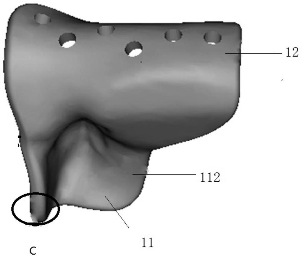 Muscle function preservation type all-temporal lower joint prosthesis