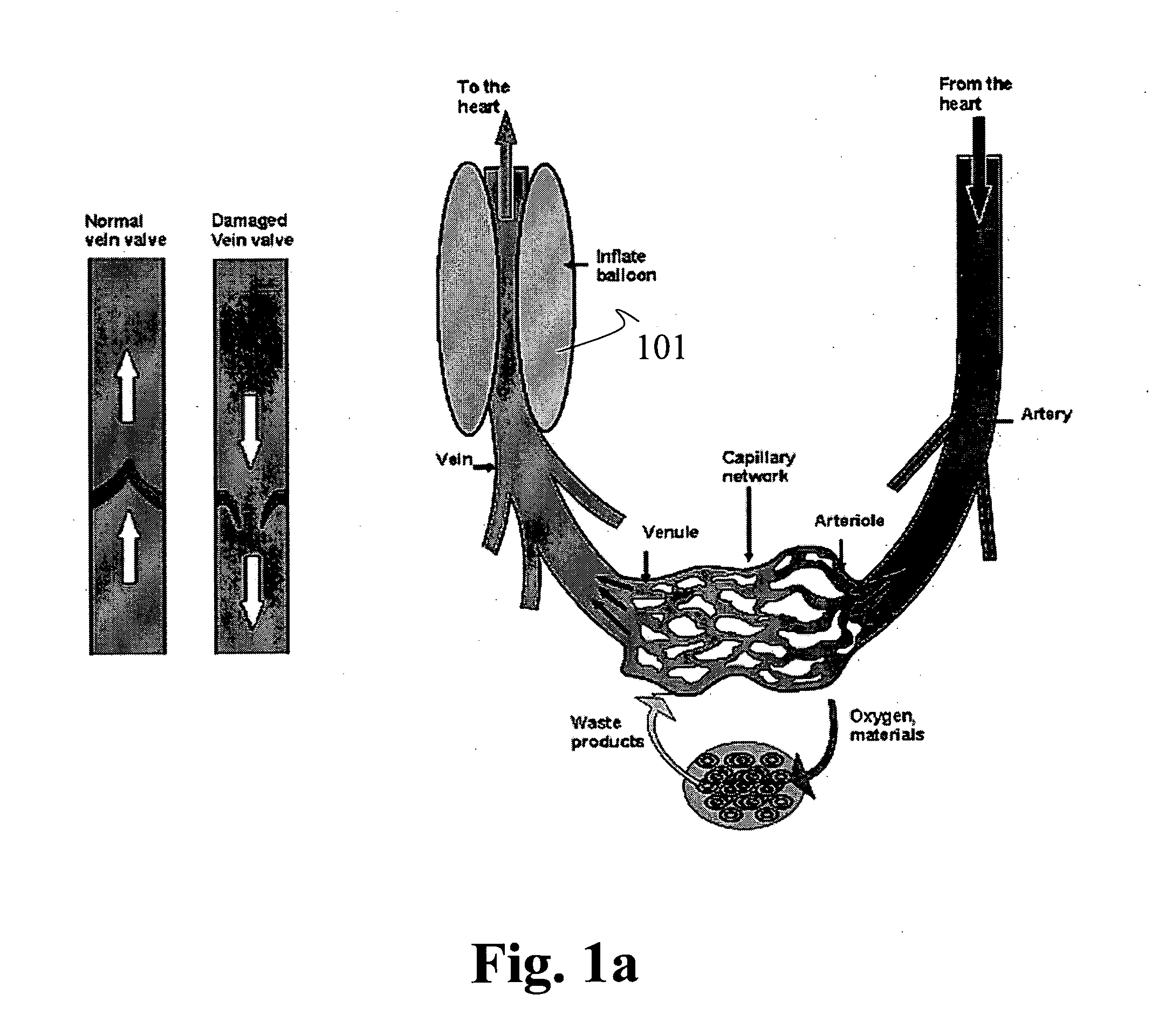 Devices for functional revascularization by alternating pressure