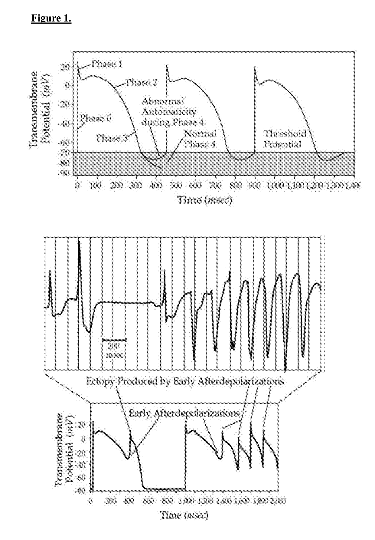 Cdc-derived exosomes for treatment of ventricular tachyarrythmias