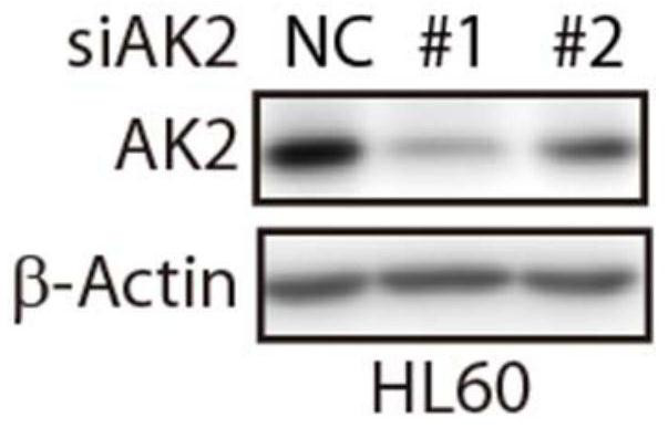 Application of AK2 gene in preparation of leukemia induced differentiation treatment medicine