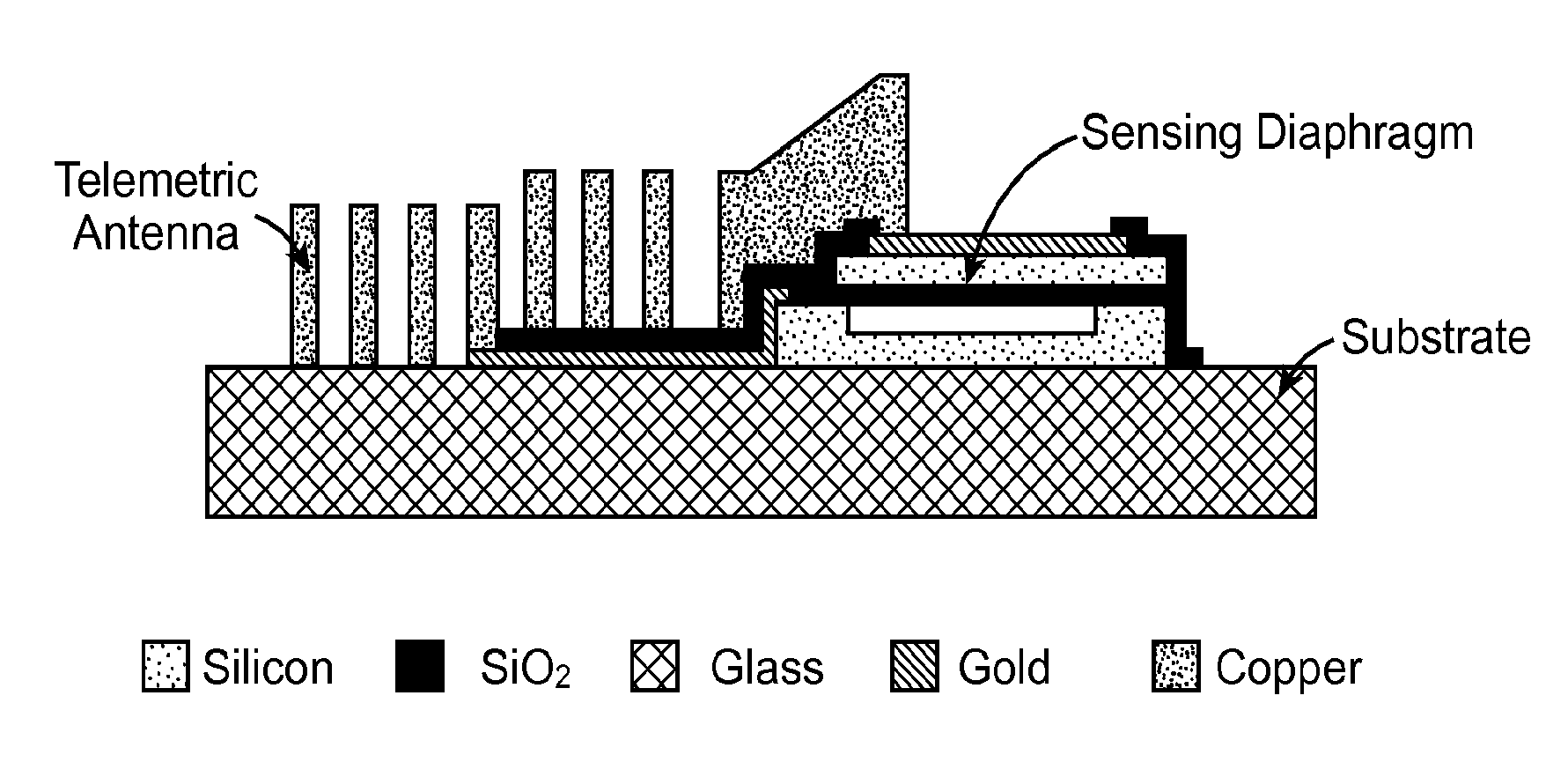 Implantable MEMS intraocular pressure sensor devices and methods for glaucoma monitoring