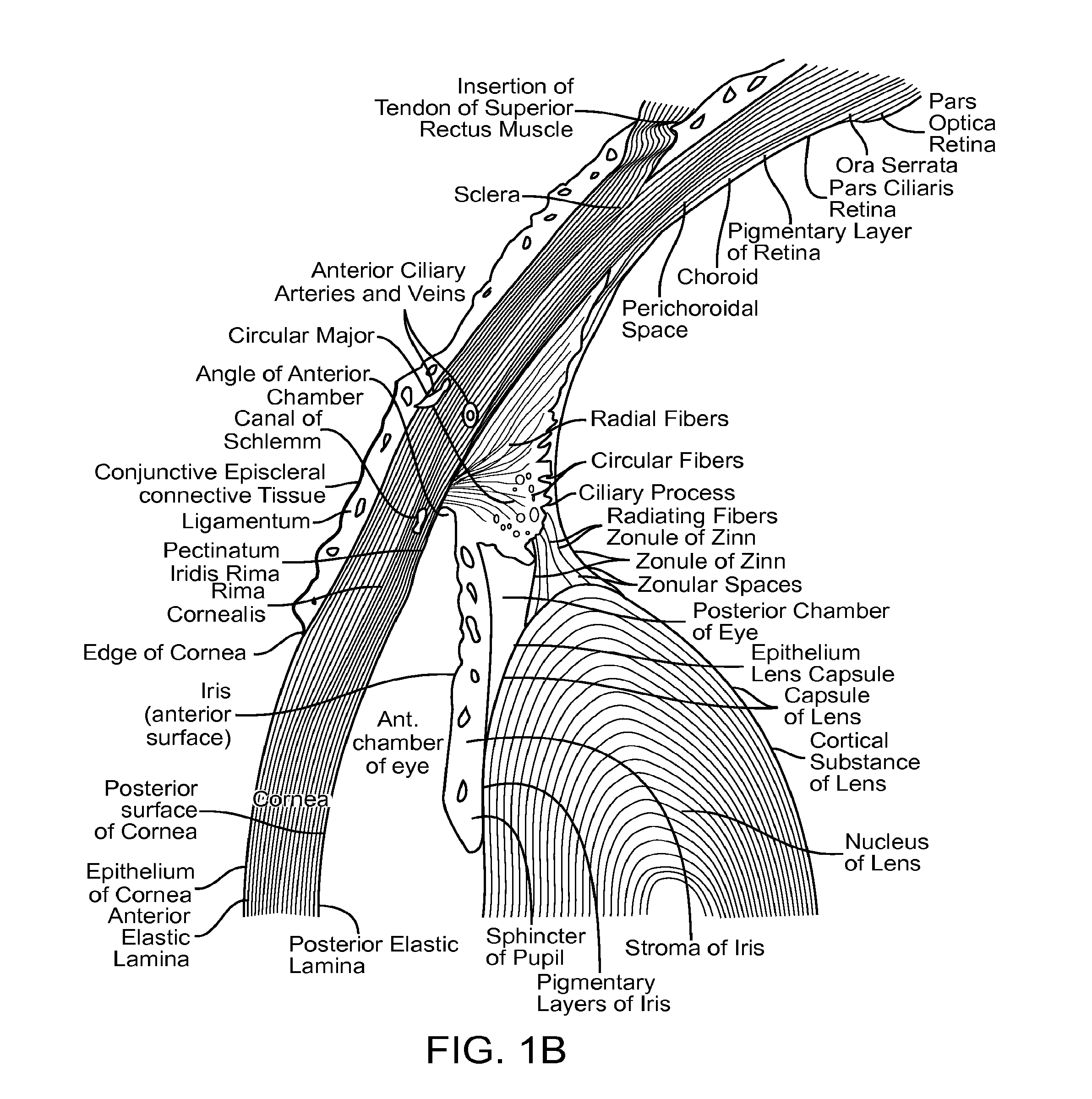 Implantable MEMS intraocular pressure sensor devices and methods for glaucoma monitoring