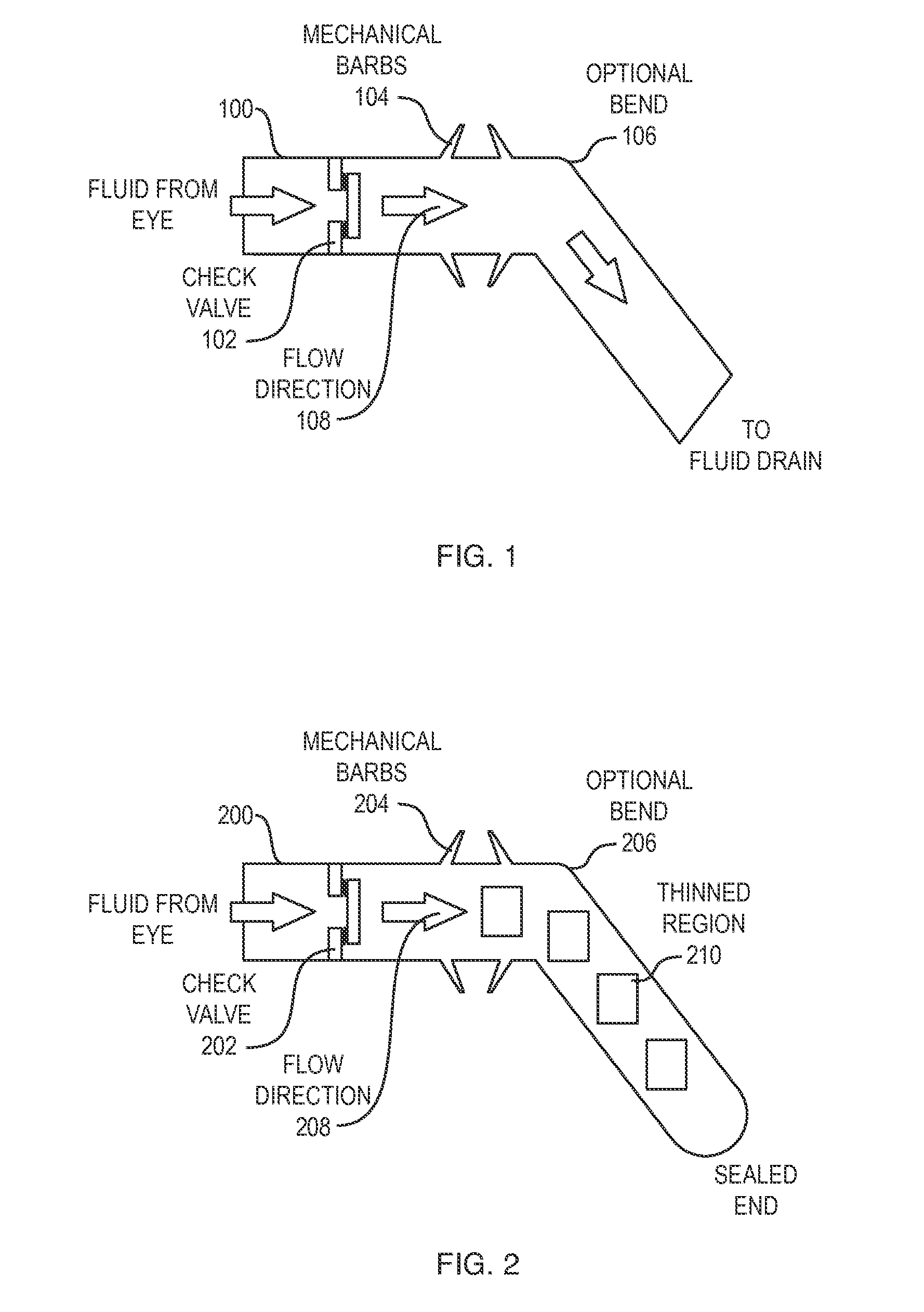 Implantable Intraocular Pressure Drain