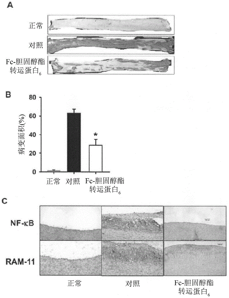 CETP antigenic peptide and fusion protein and their composition and applications