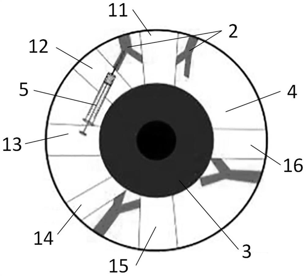 Application of lauromacrogol in preparation of chronic intraocular hypertension animal model and animal model