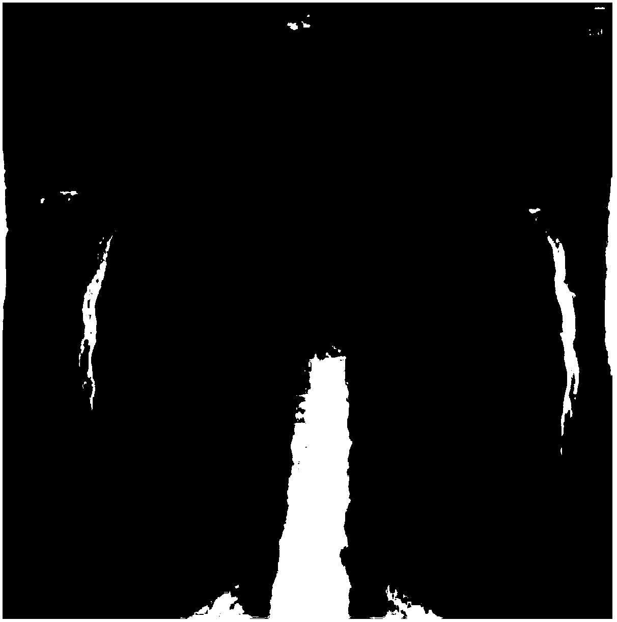 Deep learning-based pneumothorax X-ray image recognition method and system