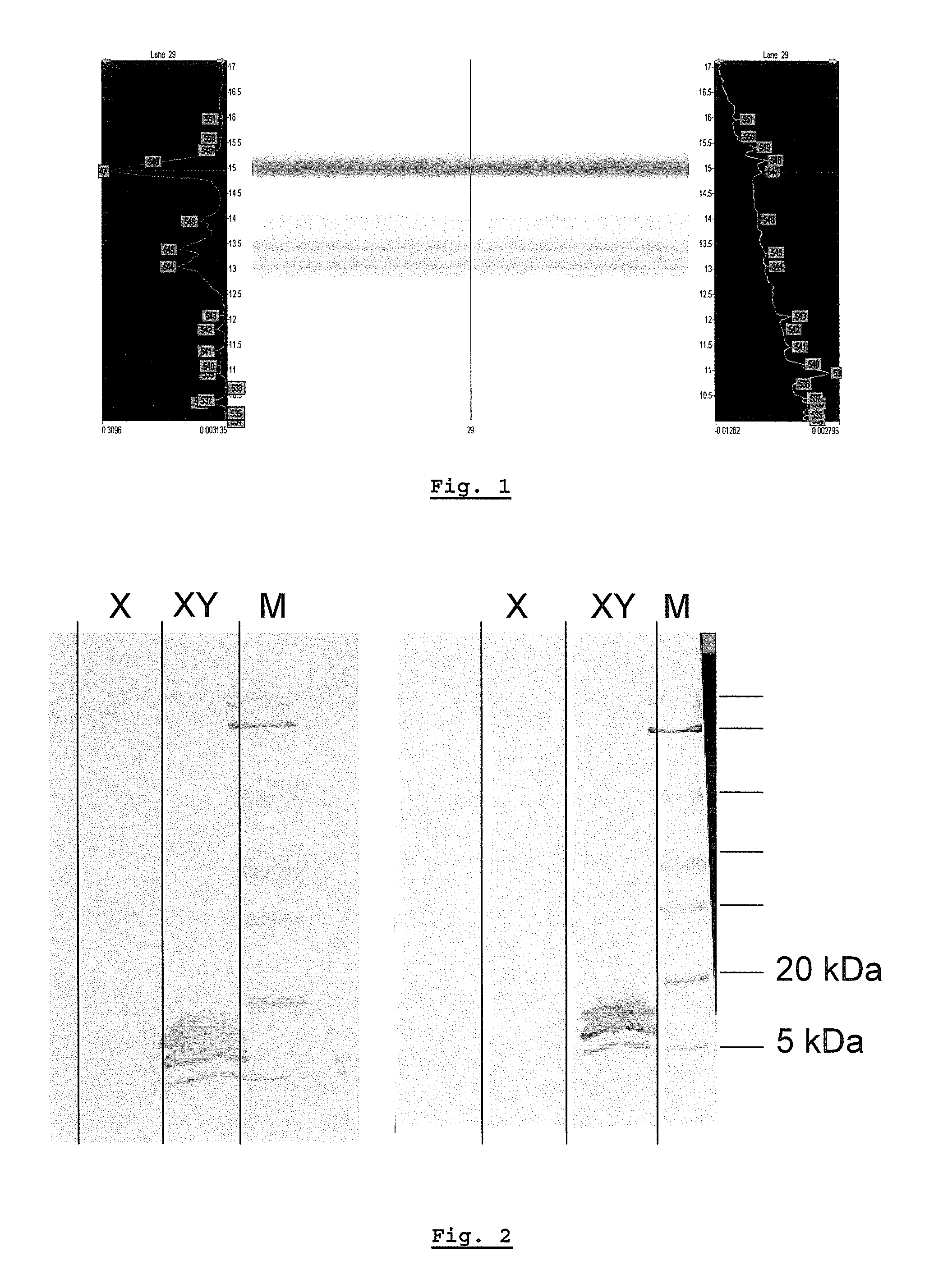 Antigenic surface structure of sperm cells associated with the y chromosome