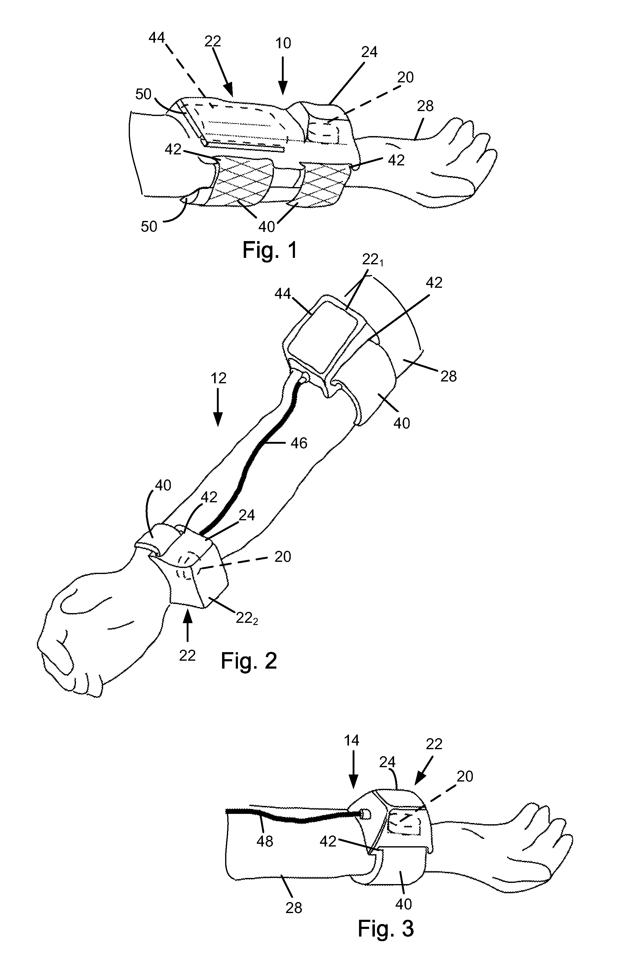 Method and device for reducing symptomatic relapse of spasticity