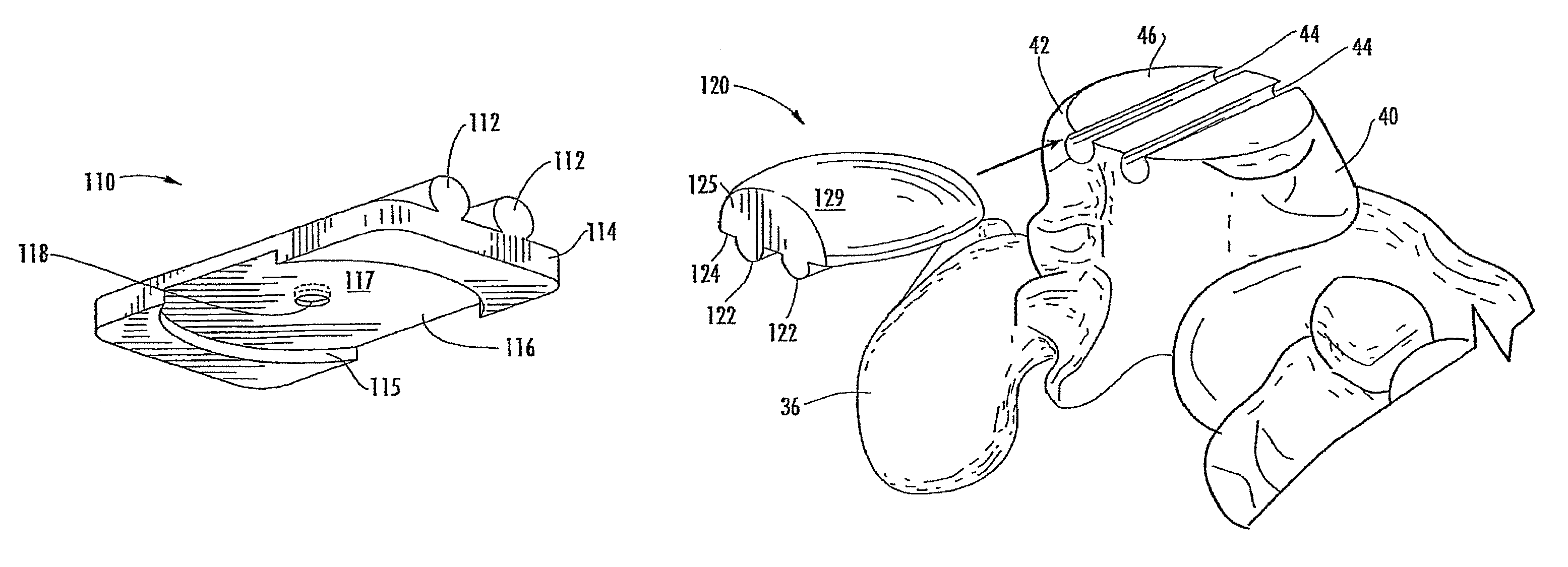 Method of preparing an ankle joint for replacement, joint prosthesis, and cutting alignment apparatus for use in performing an arthroplasty procedure