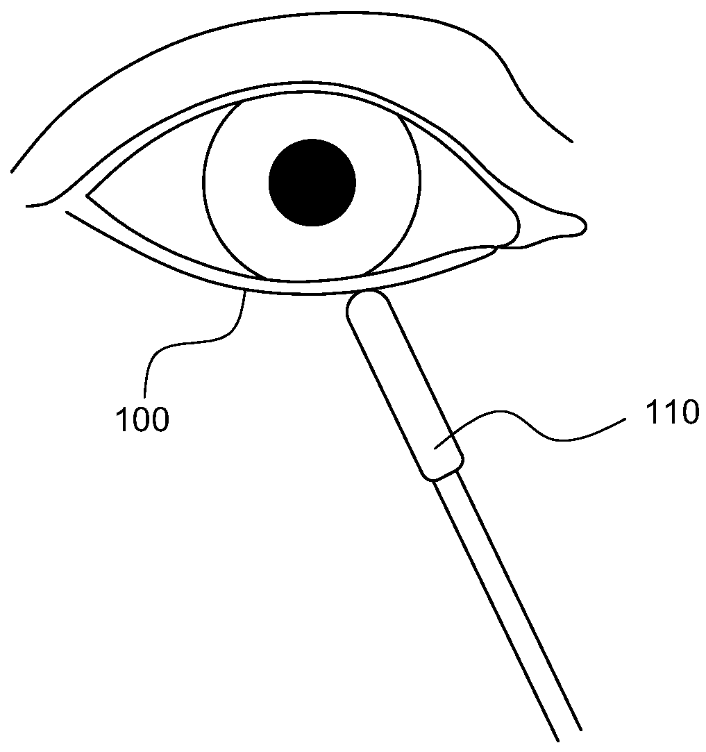 Therapeutic ultrasound for eye disorder