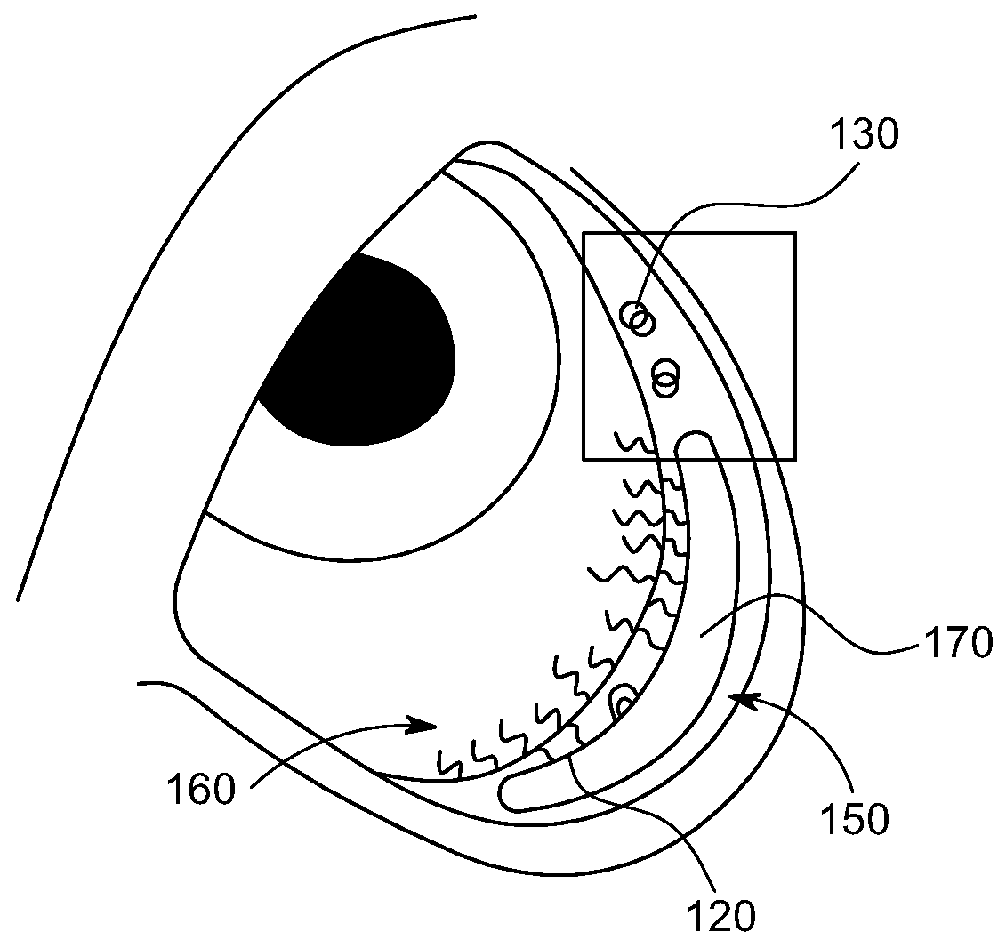 Therapeutic ultrasound for eye disorder