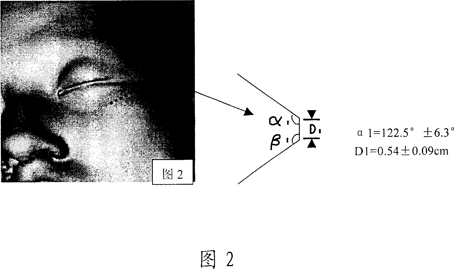 Eye wrinkle-removing film patch