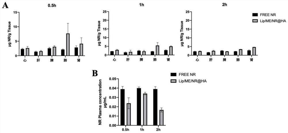 Composition containing sophora flavescens extract for pulmonary administration as well as preparation method and application of composition