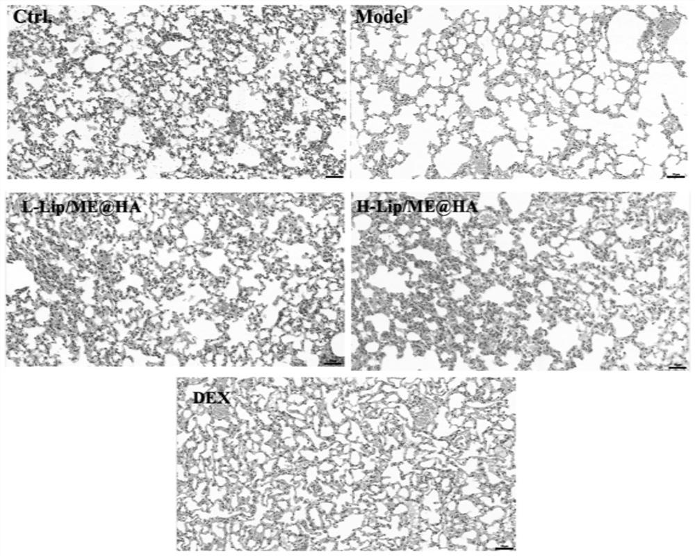 Composition containing sophora flavescens extract for pulmonary administration as well as preparation method and application of composition